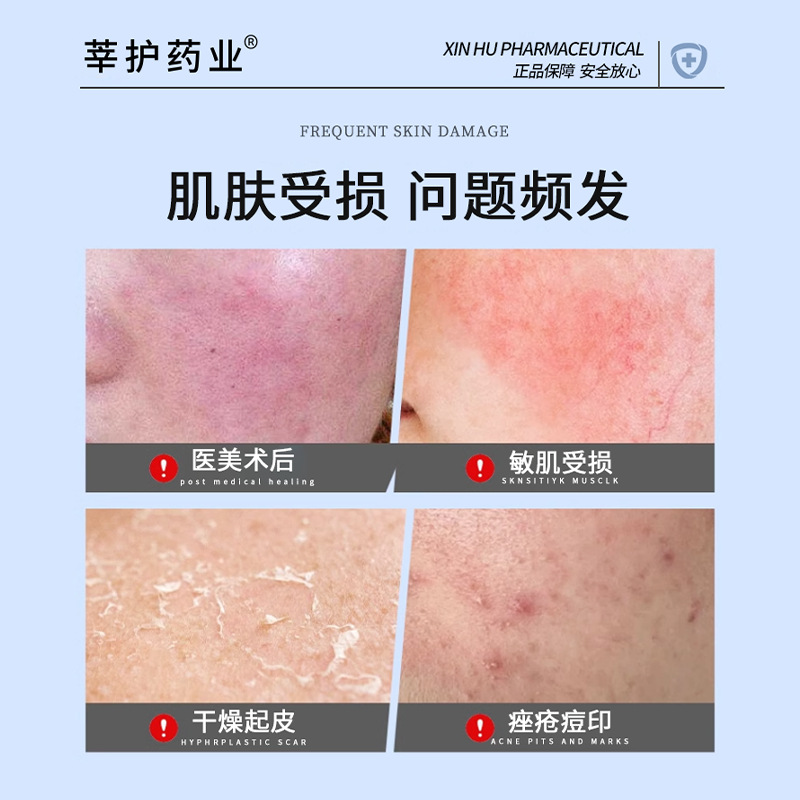 Class Ii Medical Device Facial Recombinant Collagen Medical Sterile Dressing to Fade Acne Marks and Scars, Repair and Beautify Skin, for Medical Beauty Clinics