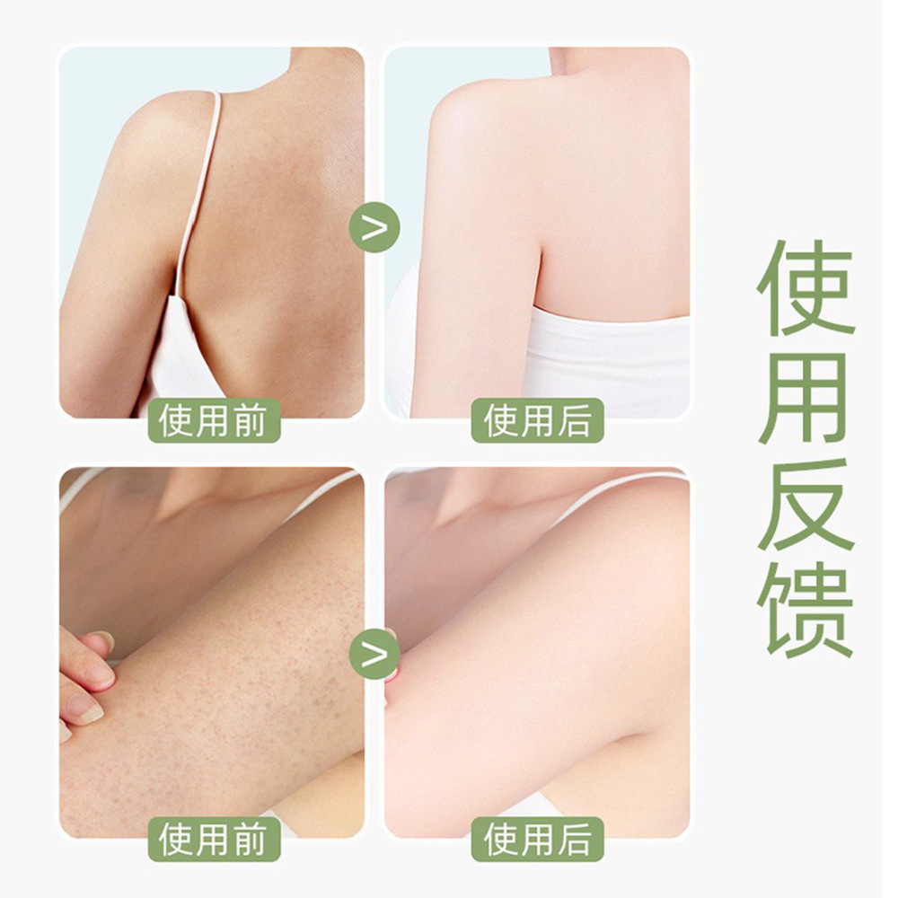 Feicaoji Scrub Exfoliating Body Scrub Bodyscrub 350ml Mild Exfoliating Chicken Skin