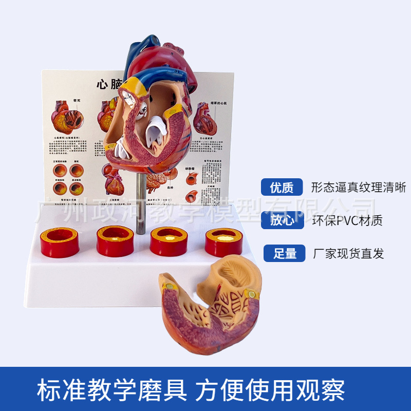 Standard Human Heart Model, Anatomical Detachable Teaching Artificial, Natural Large Heart with Blood Clot Blood Vessel Model