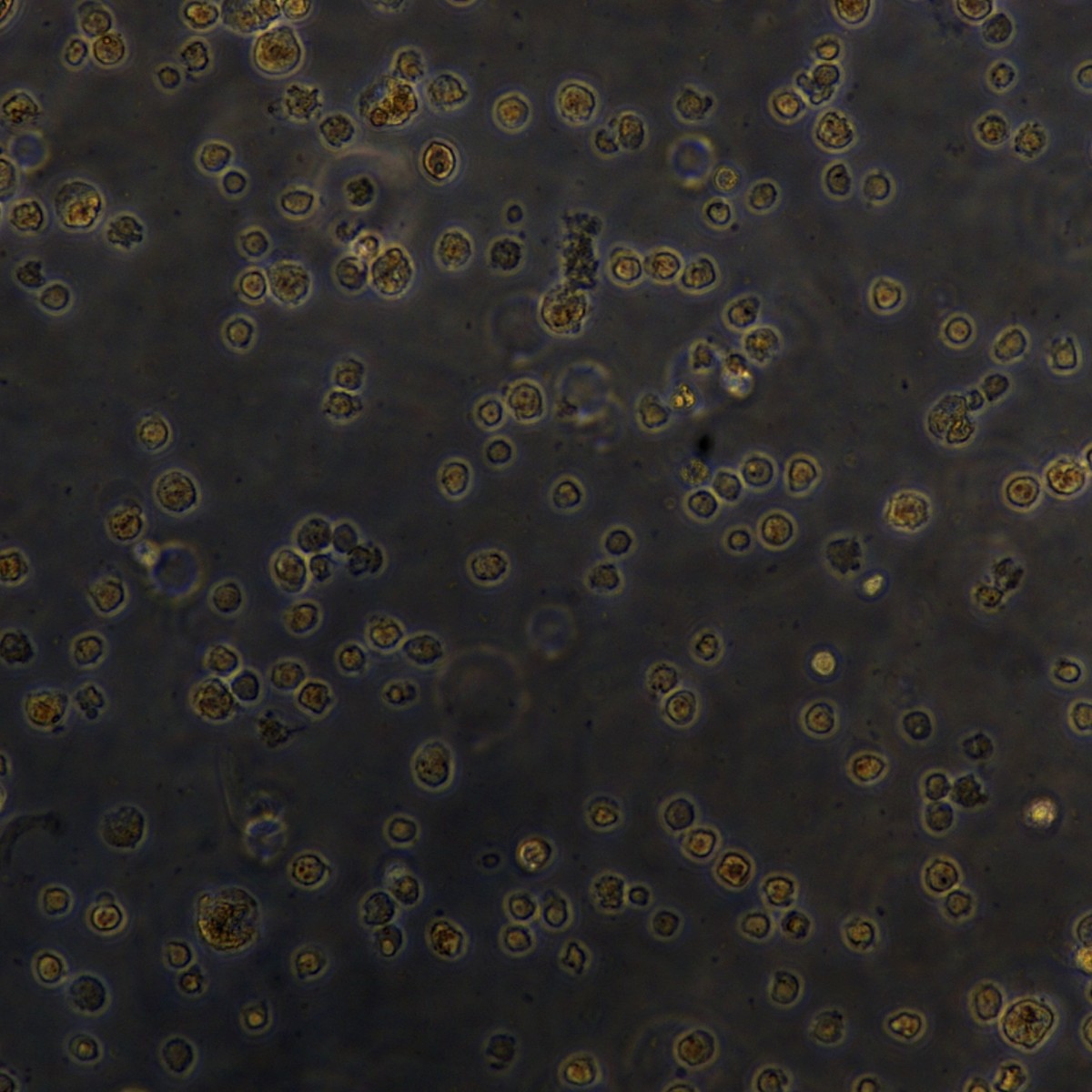 Meisen Ctcc хронический миелоидный лейкоз, штам, устойчивый к иматинибу K562/Imatinib