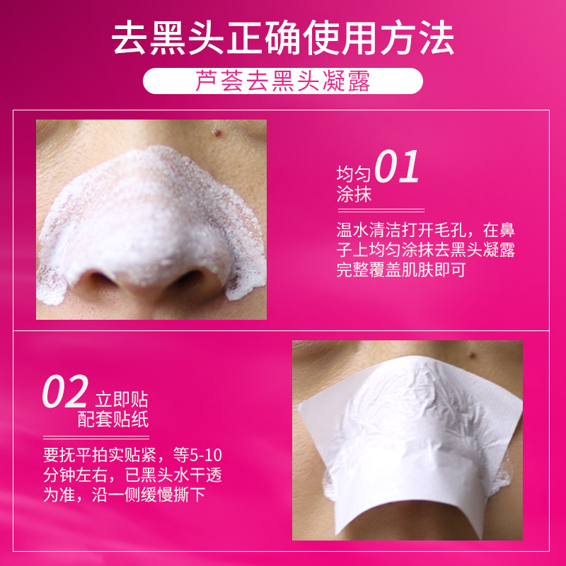 General trade Thailand blackhead removing nose patch Garysoon white aloe vera gel unisex pig nose patch