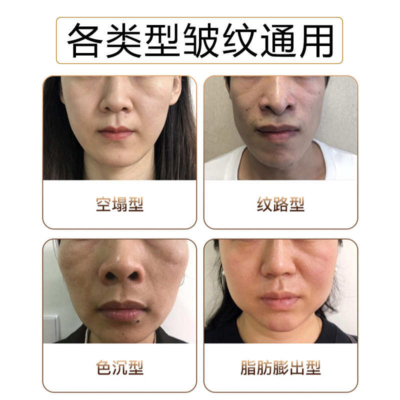 Collagen Filled Powder Cream Filled with Depressions to Lift Pattern Fade Fine Pattern Compact Vc Filled Powder Cream