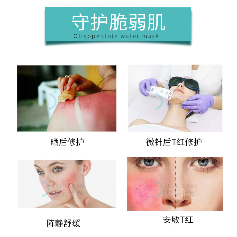 Soothing Skin repair cold gel damaged sensitive skin fading red hydrating tender skin cuticle damaged blue ketone peptide fading red gel