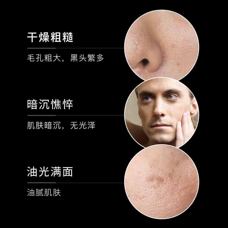 Fanzhen men's skin care products suit moisturizing moisturizing refreshing skin care three-piece set men's skin care Box Wholesale