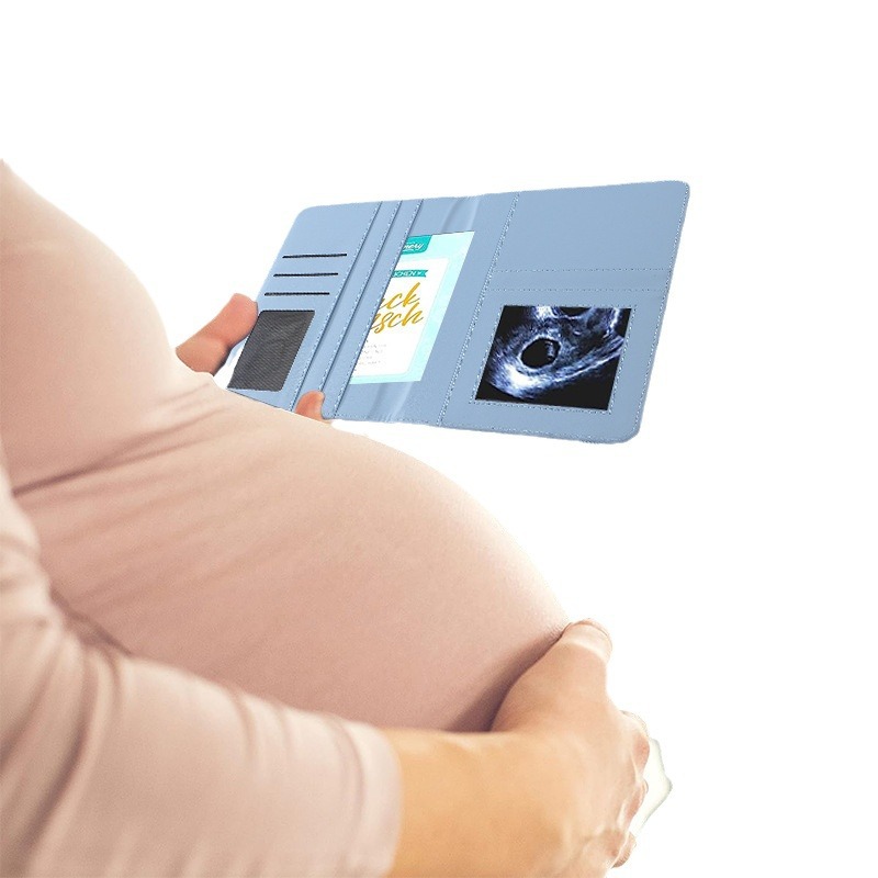 The cover of the cross-border special A5 maternity log is equipped with partitions such as ultrasound image insurance card vaccination certificate.