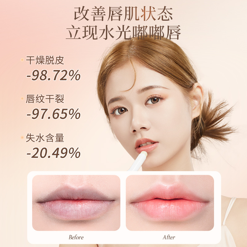 Bodybuilding Research Vaseline VC Lip Balm Women Moisturizing Moisturizing Hydrating Anti-dry Cracking Lip Balm Care Lip Balm for Men and Women