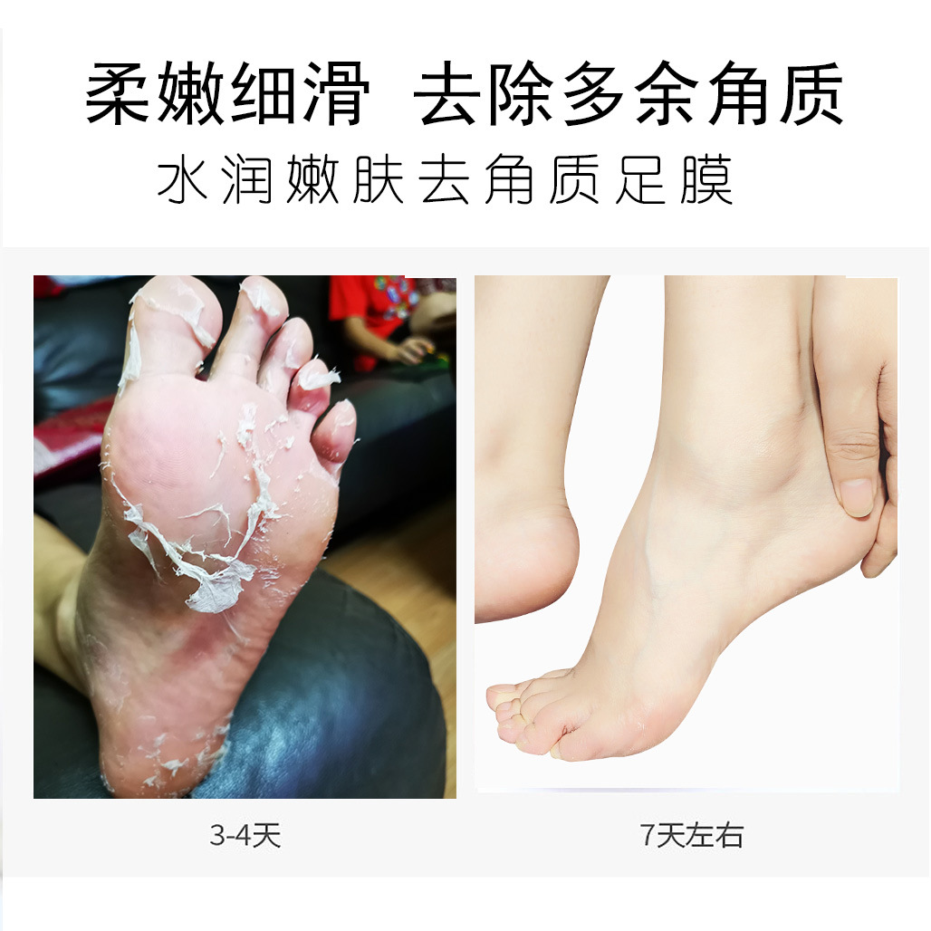 Yidai Exfoliating Foot Mask, Foot Mask to Remove Dead Skin, Peeling and Remove Calluses, Foot Patch, Foot Mask, Foot Care Foot Mask