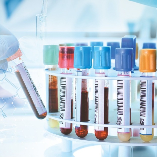 Одноразовая стеклянная трубка для сбора крови с отрицательным давлением, обычная трубка для сбора крови производитель