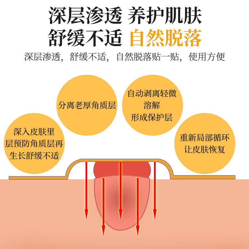 Customized Size Corn Patch Manufacturer Corn Patch Corn Paste to Relieve Foot Corn Discomfort Wholesale Processing