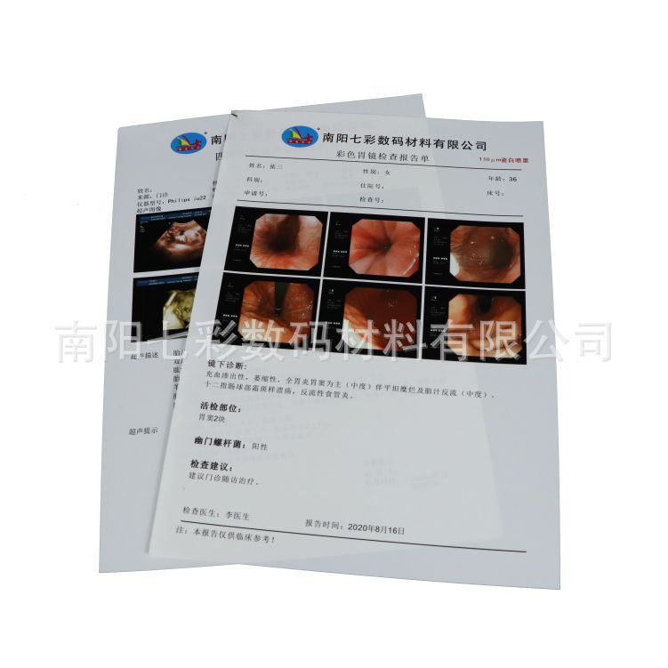 A4 medical porcelain white B ultrasound electronic gastrointestinal mirror white ink jet 150MB printing film