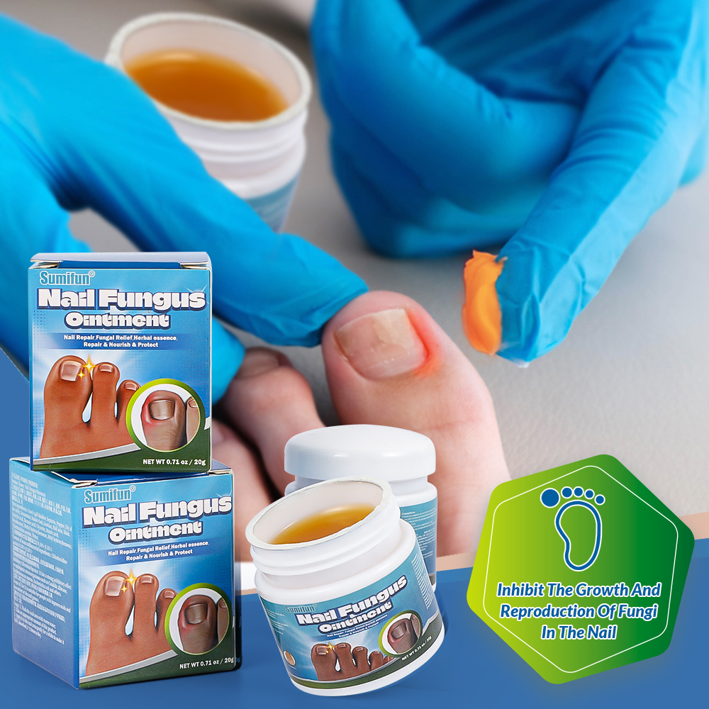 Sumifun Cross-Border Specializes in Providing Nail Groove Care Ointment, Nail and Toenail Care Health Ointment K20029