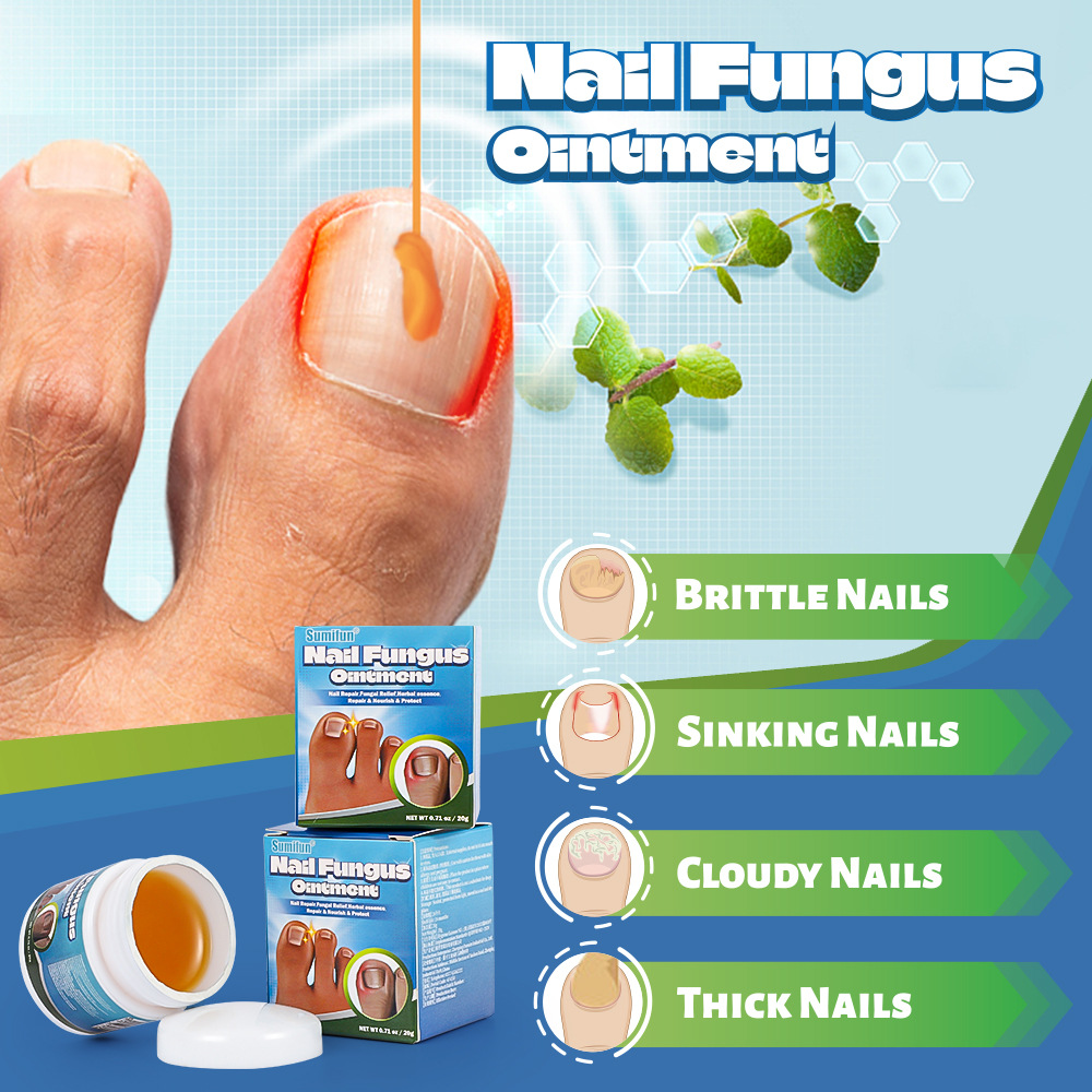 Sumifun Cross-Border Specializes in Providing Nail Groove Care Ointment, Nail and Toenail Care Health Ointment K20029