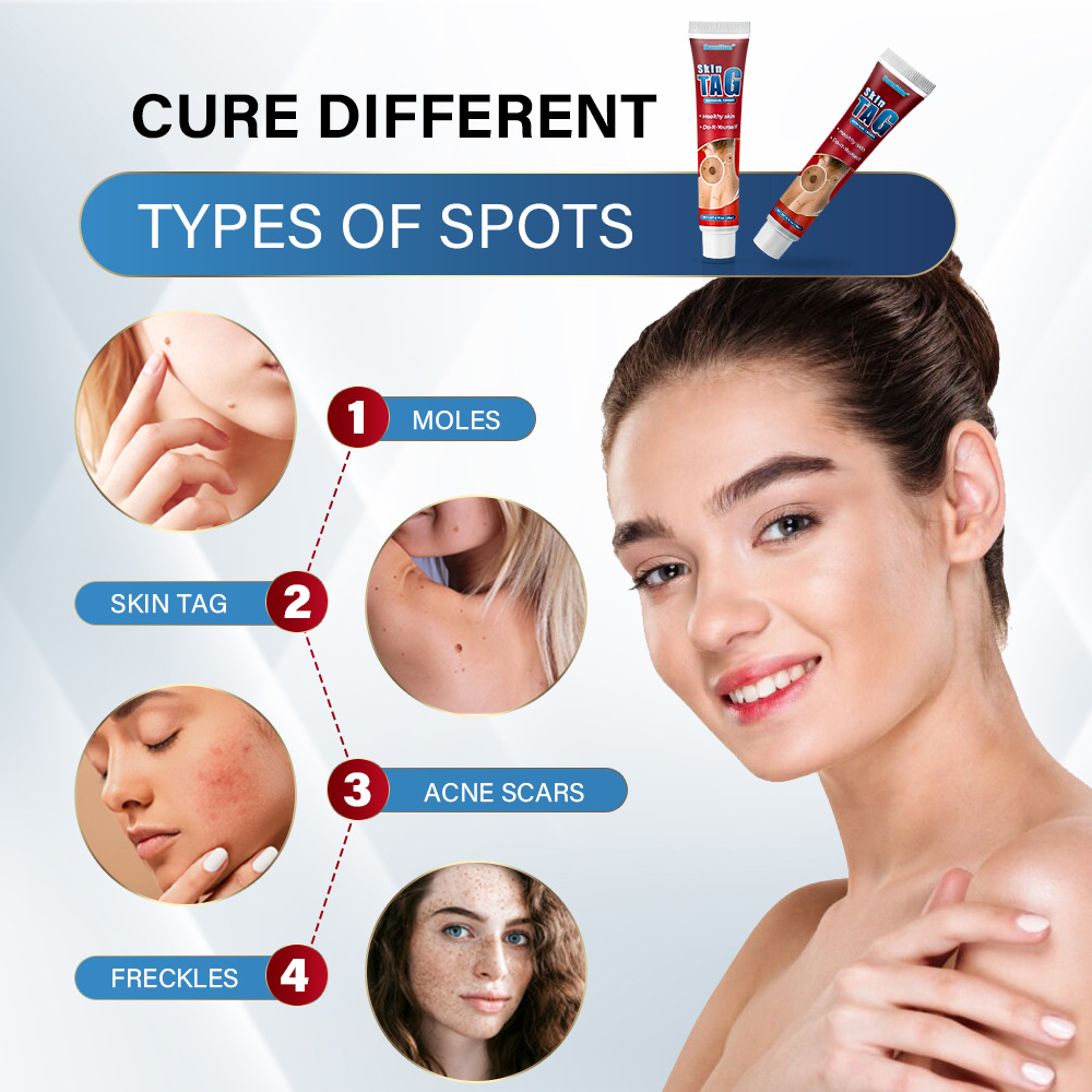 Sumifun Cross-Border Wart Cream, External Health Care Cream for Warts, Corns, Skin Care Cream, Foreign Trade Plaster Wholesale K10097