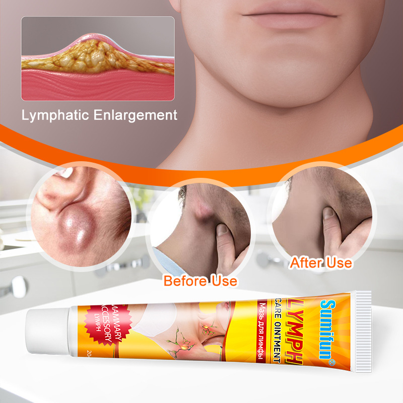 Sumifun Cross-Border Lymphatic Ointment, Unblocking Health Care Ointment, Shopee Noon Amazon Cross-Border Foreign Trade Wholesale K10018